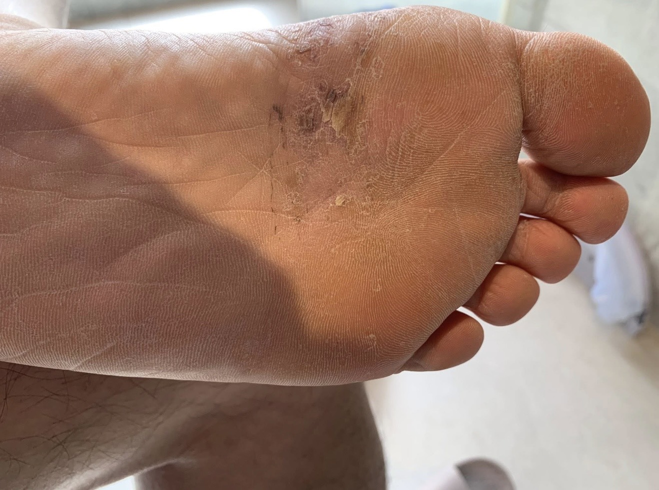 院長張長志醫師幸福專欄-皮膚抓抓癢癢，換季真的好困擾❗️❗️20251119